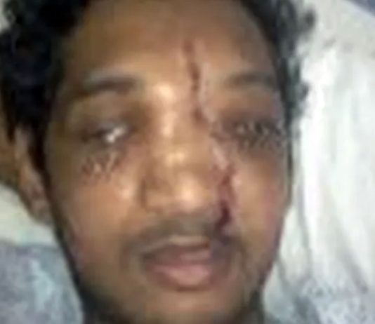 an appeal from Joe d’Souza on behalf of Melwyn Noronha MELWYN NORONHA